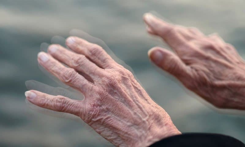علاج الشلل الرعاش