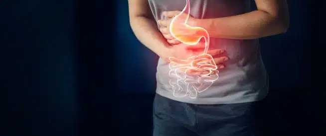 علاج القرحة نهائيا