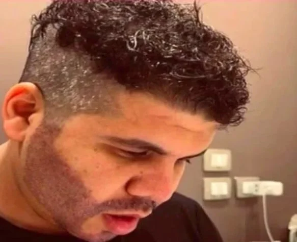 عمر كمال قبل وبعد عمليات التجميل