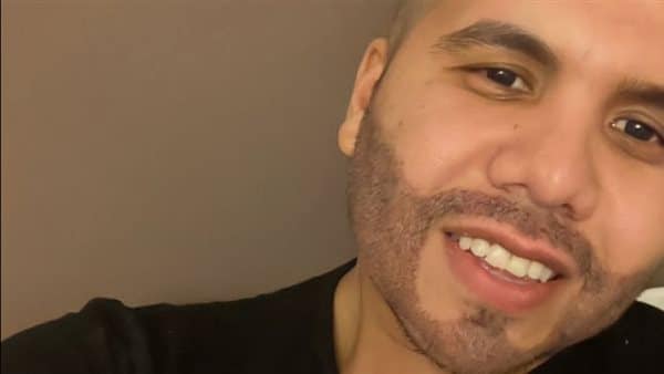 عمر كمال قبل وبعد عمليات التجميل،