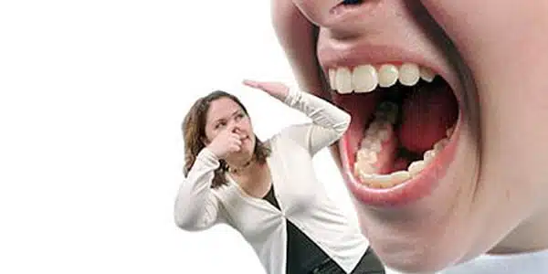 علاج مرارة الفم