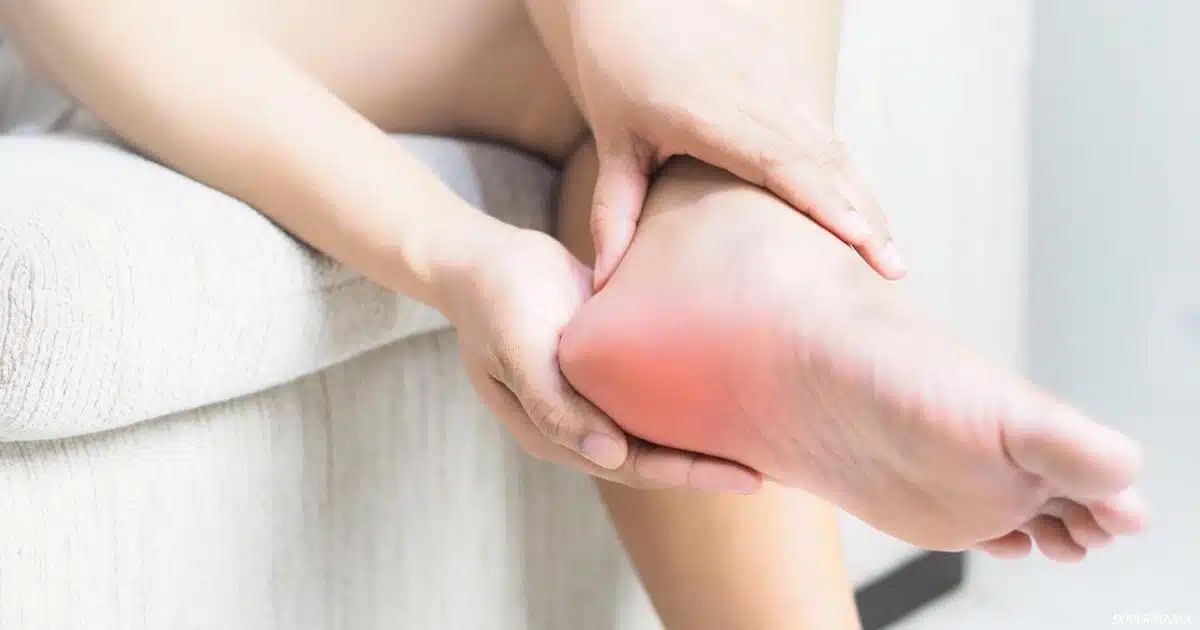علاج مسمار القدم