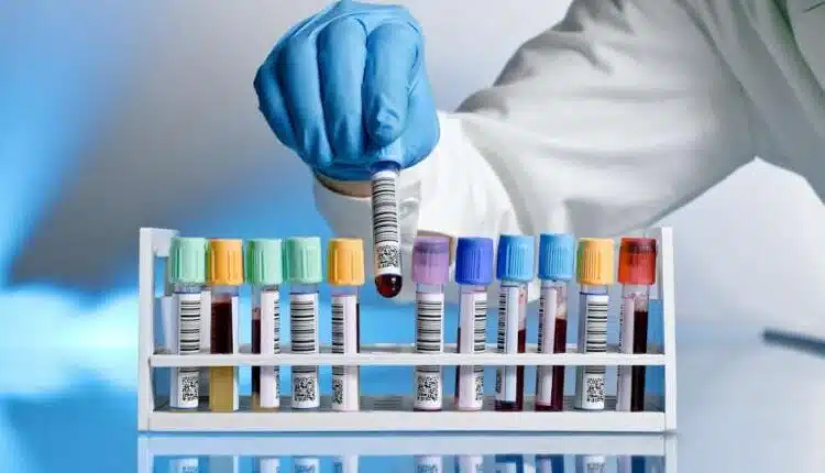 عقوبة تزوير شهادة فحص الزواج في مصر